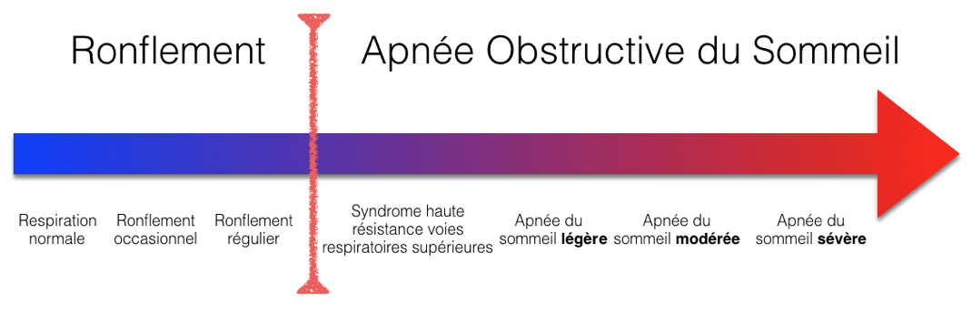 Apnée du sommeil: le dormeur par intervalles - La Liberté